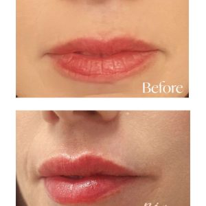 WhatsApp Image 2025-08-26 at 10.01.54 (1)-tiny