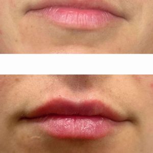 WhatsApp Image 2025-08-26 at 10.02.27-tiny