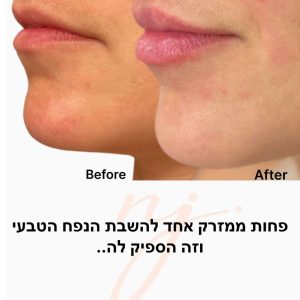 WhatsApp Image 2025-08-26 at 10.02.28 (1)-tiny