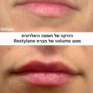 WhatsApp Image 2025-08-26 at 10.02.28-tiny