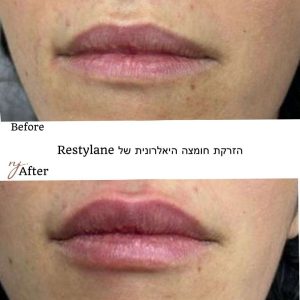 WhatsApp Image 2025-08-26 at 10.02.29 (1)-tiny