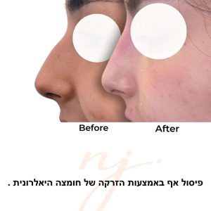 WhatsApp Image 2025-08-26 at 10.02.29-tiny