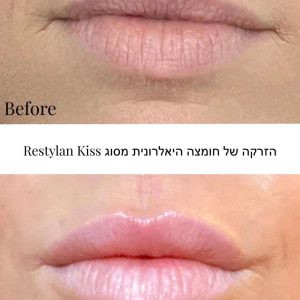 WhatsApp Image 2025-08-26 at 10.29.41-tiny