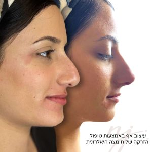 WhatsApp Image 2025-08-26 at 10.30.07-tiny