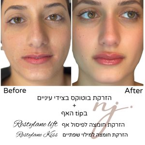 WhatsApp Image 2025-08-26 at 10.30.08 (1)-tiny