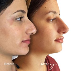 WhatsApp Image 2025-08-26 at 10.30.09 (1)-tiny